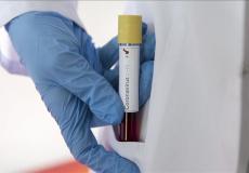 فيروس كورونا الوفيات والاصابات ترتفع بالدول الاوروبية والصين تسيطر