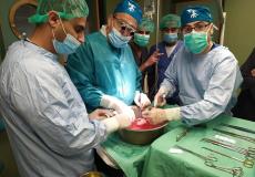 الأطباء أثناء إجراء عملية زراعة الكلى