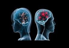 دماغا المرأة والرجل