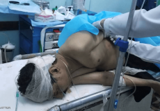 اصابة نتيجة القصف