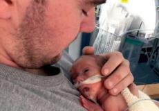 احتضن الوالد الطفلة فبدت بحجم يده