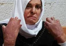  الأسيرة المقدسية إسراء الجعابيص