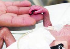 طفل حديث الولادة - توضيحية