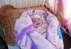 صورة الطفلة