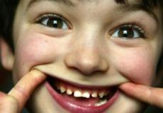 يحرص أطباء الأسنان في بريطانيا عند فحص أسنانهم على وضع مادة الفلوريد لحمايتها من التسوس