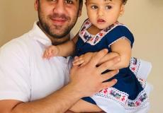 الطفلة ميلا