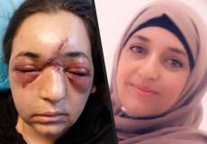 الفلسطينية رينا درباس