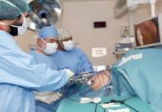 تكميم المعدة