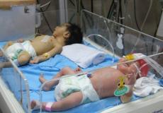 الاطفال الخدج في الحضانات في مستشفى شهداء الاقصى