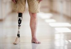 حملة لتركيب اطراف صناعية في لبنان