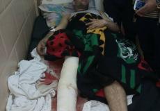 جريح من غزة : وقفة احتجاجية يوم الخميس للمطالبة بتوفير تحويلات طبية خارج غزة 