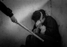 هزت السعودية - يحرق زوجته بعد حلق شعرها