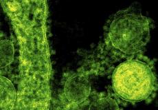 هل المتعافون من فيروس كورونا لا ينقلون العدوى .. دراسة تكشف