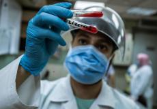 مصر تختبر بلازما المتعافين كعلاج لكوفيد 19