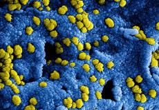 دراسة أمريكية تثير الجدل حول إمكانية علاج فيروس كورونا بالضوء