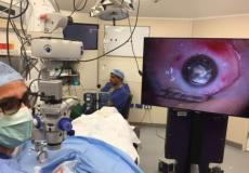 طبيب عيون -صورة تعبيرية-