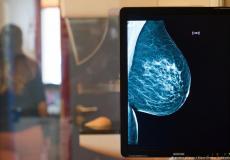 تؤكد منظمة الصحة العالمية أن سرطان الثدي من أكثر أنواع السرطانات انتشارا بين النساء