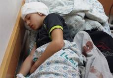 اصابة طفل -ارشيفية 