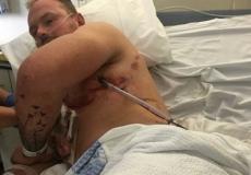 عامل ينجو بأعجوبة