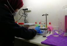 صحة الخليل توضح الحالة الصحية للمصابين الثلاثة بفيروس كورونا