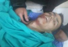 الشهيد الفنى محمد الحطاب