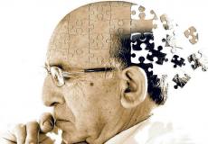 مرض الزهايمر - توضيحية