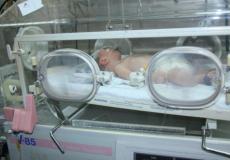 صورة الجنين بعد العملية