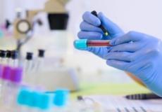 اختبار الدم الجديد يكلف 50 جنيها استرلينيا