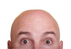 رجل أصلع - توضيحية