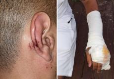 أحد الشبان المعتدى عليه