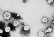 صورة مجهرية لفيروس كورونا