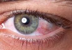 كورونا يؤثر على العيون