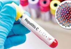 احصائية منظمة الصحة العالمية عن المصابين بمرض التهاب الكبد الفيروسي