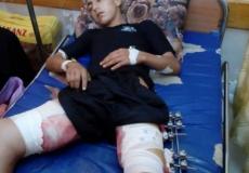 الجريح يوسف محمد القطراوي 