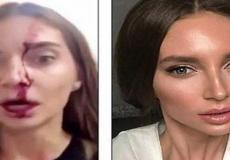 تعرض الممثلة الروسية فالتينا سيدور للضرب المبرح