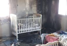 إصابة طفيفة أثر احتراق بيت في النقب