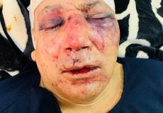 حقيقة وفاة أبو بكر الاجنف