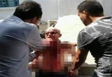محاولة انتحار على طريقة البوعزيزي في تونس