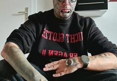 شاب الماني-ساندرو-إزالة-أذنه