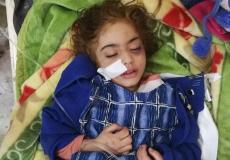 وفاة الطفلة رهف