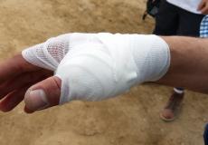 إصابة المصور الصحفي محمد الصوالحى باليد