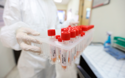تسجيل 7 إصابات جديدة بفيروس كورونا في الخليل