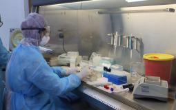 طبيب يعاين عينات فيروس كورونا في غزة