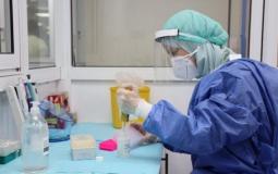 الفحص السريع لكورونا