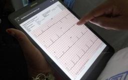 جهاز تنظيم ضربات القلب دون بطارية