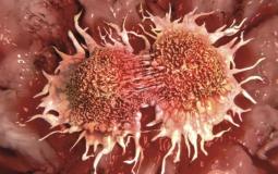 خلايا سرطانية - صورة تعبيرية