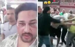 حمو بيكا وحرسه يعتدون بالضرب على شاب لهذا السبب الغريب!