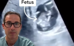 الطبيب الكندي مايكل نارفي أثناء عرضه الفيديو للطفل داخل الكبد