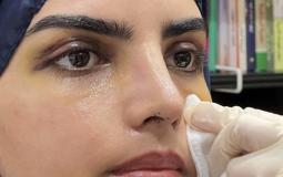 سارة الودعاني في أول ظهور بعد عملية التجميل