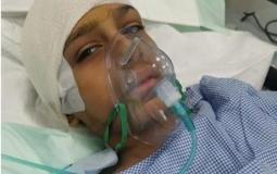 طالب يتعرض لكسر في الجمجمة بالسعودية